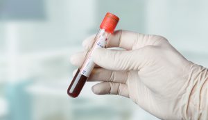 blood cancer سرطان خون
