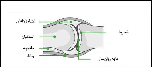 آرتروز