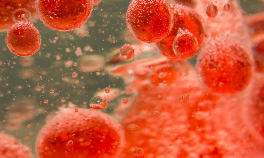 نگاهی به نقش استاتین‌ها در درمان بیماری چربی خون