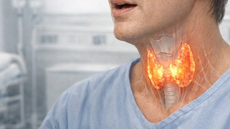 سرطان تیروئید چیست؟ علت‌ها، علائم و درمان