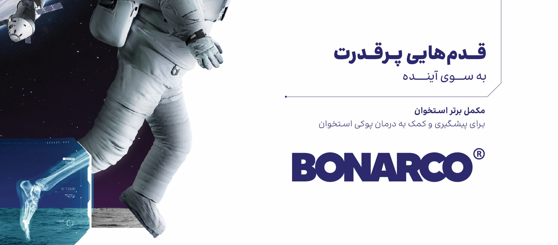 بون‌آرکو